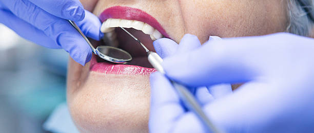 Best Emergency Dental Care for Broken or Chipped Teeth in Uniontown, PA